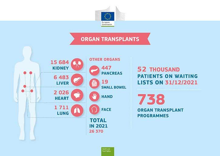 Infographic - Organs